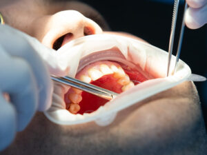 endodontia