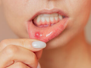 patologia bucal