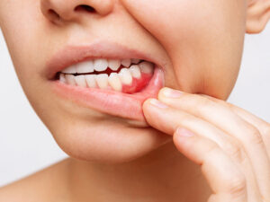 periodontia