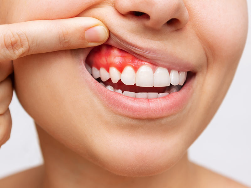 periodontia